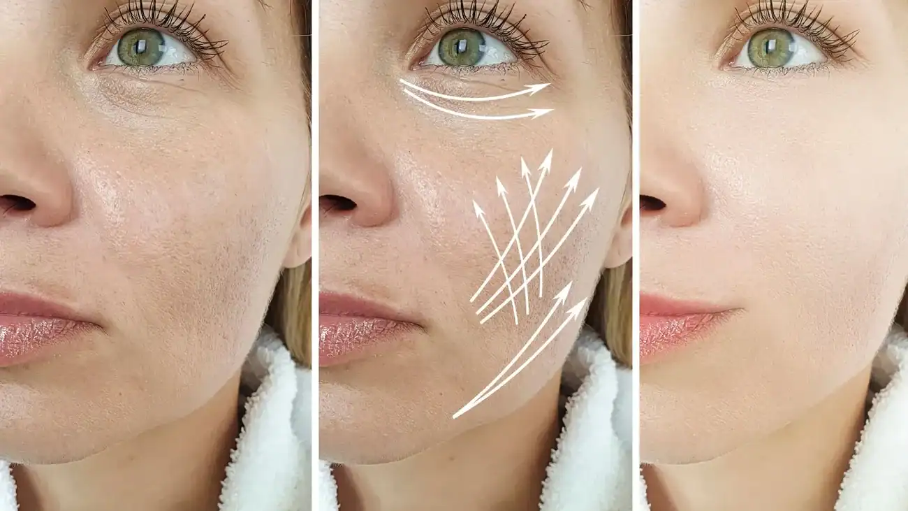 Can One Treatment Really Tackle More Than One Skin Concern Brent?