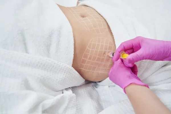 image of fat dissolving injections on love handles to help combat weight gain Brent