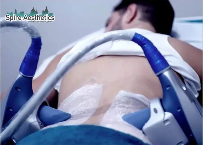 Man having fat freezing treatment done on love handles before a competitions Brent to create a sculpted look.