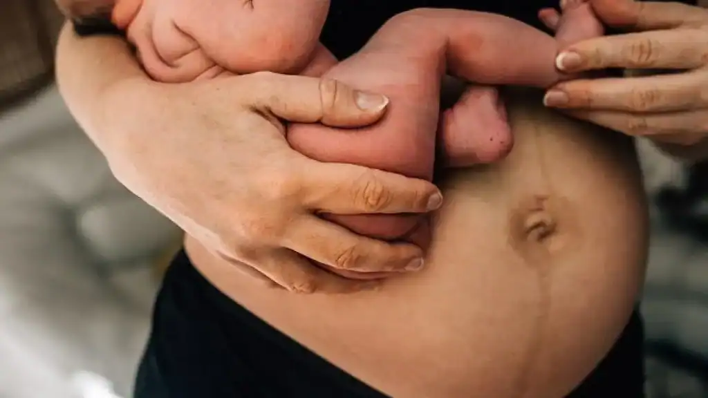 Why Is My Stomach Still Big After Pregnancy Brent?